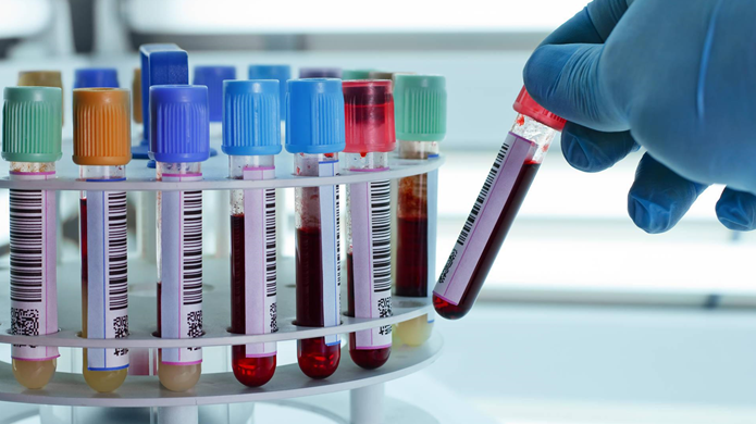Расшифровка анализов крови на гепатит С